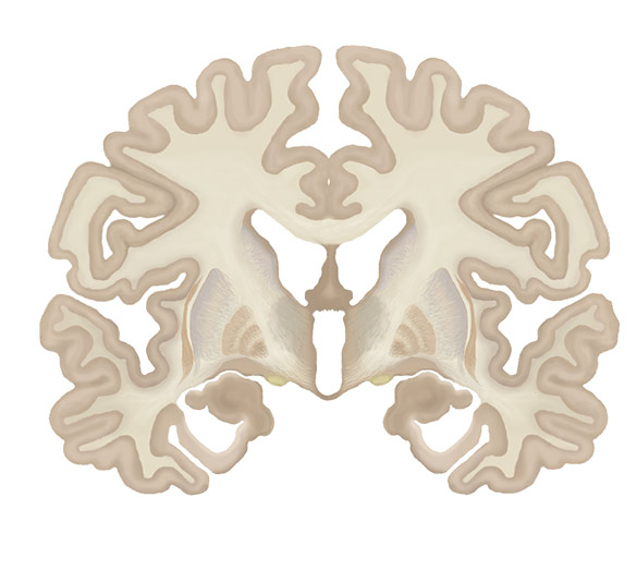 Coronal Brain Slice